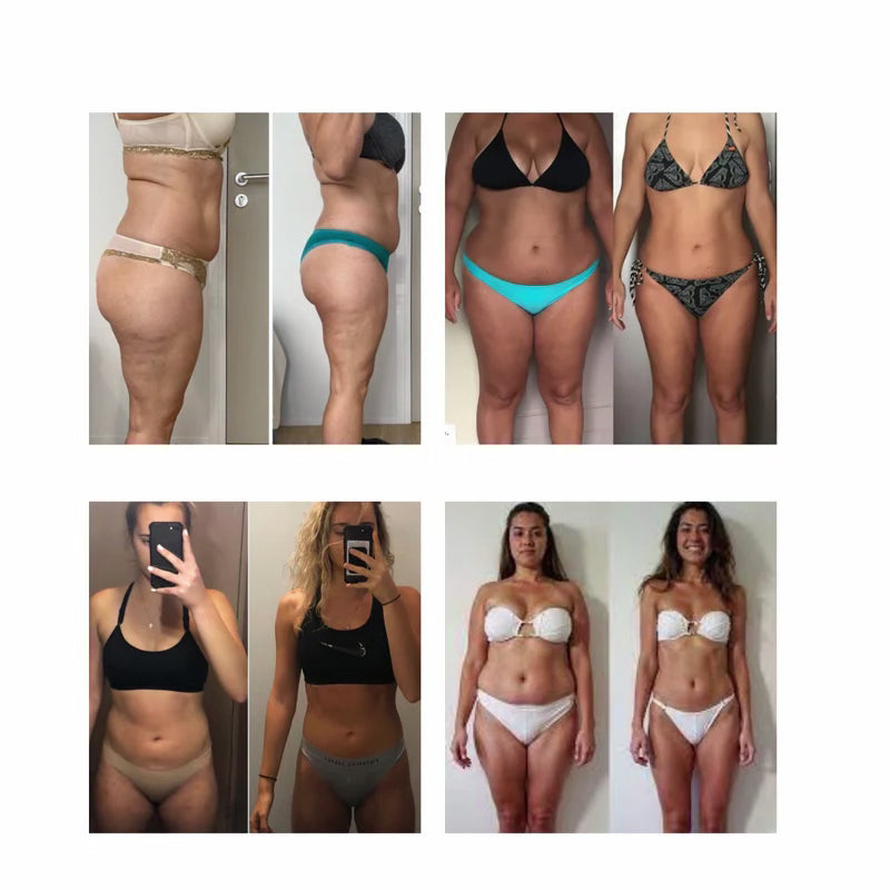 Mira Patch GLP-1 | Weight Loss